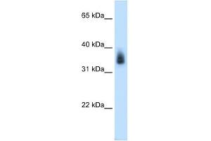 MAGEA8 antibody used at 0. (MAGEA8 anticorps  (N-Term))