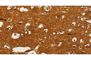 Immunohistochemistry of paraffin-embedded Human brain using GOT1 Polyclonal Antibody at dilution of 1:50