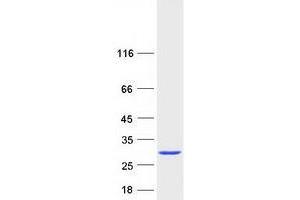 Validation with Western Blot