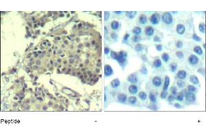 Image no. 1 for anti-Mechanistic Target of Rapamycin (serine/threonine Kinase) (mTOR) (Ser2481) antibody (ABIN401643) (MTOR anticorps  (Ser2481))