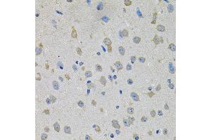 Immunohistochemistry of paraffin-embedded mouse brain using PTK7 antibody at dilution of 1:100 (x40 lens).