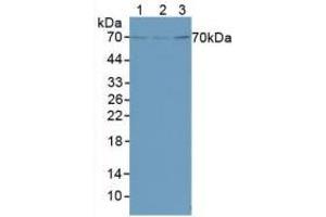 Figure. (FOXO1 anticorps  (AA 222-469))
