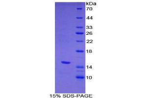 SDS-PAGE (SDS) image for Heparanase (HPSE) (AA 353-464) protein (His tag) (ABIN2121228) (HPSE Protein (AA 353-464) (His tag))