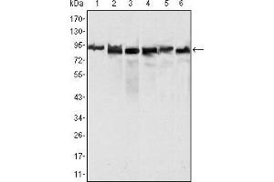 Western blot analysis using MLH1 mouse mAb against Hela (1), MCF-7 (2) and A549 (3), Jurkat (4), 2R75 (5) and COS (6) cell lysate. (MLH1 anticorps  (AA 381-483))