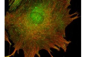 Immunocytochemistry (ICC) image for anti-CAP-GLY Domain Containing Linker Protein 1 (CLIP1) (AA 1283-1438) antibody (ABIN1742486) (CLIP1 anticorps  (AA 1283-1438))