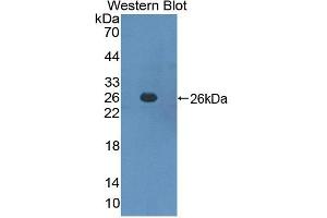 Western blot analysis of the recombinant protein. (SOCS3 anticorps  (AA 1-225))