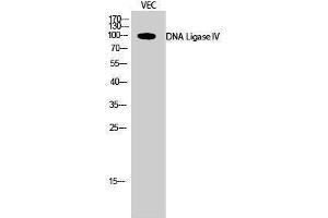 Western Blotting (WB) image for anti-Ligase IV, DNA, ATP-Dependent (LIG4) (Internal Region) antibody (ABIN3184324) (LIG4 anticorps  (Internal Region))