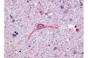 Immunohistochemical staining of Brain (Neurons and glia) using anti- NTSR1 antibody ABIN122340 (NTSR1 anticorps  (N-Term))