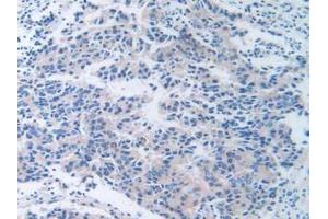 Figure. (TTR anticorps  (AA 21-147))