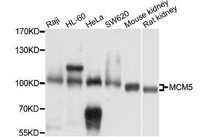Western blot analysis of extracts of various cell lines, using MCM5 antibody. (MCM5 anticorps  (AA 1-230))