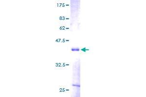 Image no. 1 for Midkine (Neurite Growth-Promoting Factor 2) (MDK) (AA 1-143) protein (GST tag) (ABIN1310599)
