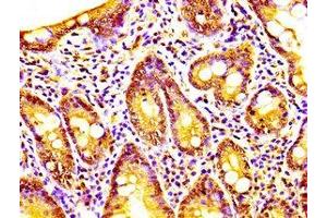 IHC image of ABIN7146664 diluted at 1:200 and staining in paraffin-embedded human small intestine tissue performed on a Leica BondTM system.