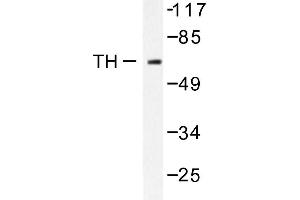 Image no. 1 for anti-Tyrosine Hydroxylase (TH) antibody (ABIN271919) (Tyrosine Hydroxylase anticorps)