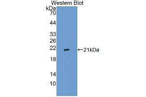 Western Blotting (WB) image for anti-Integrin Alpha2b (CD41) (AA 891-1039) antibody (ABIN1868769) (Integrin Alpha2b anticorps  (AA 891-1039))