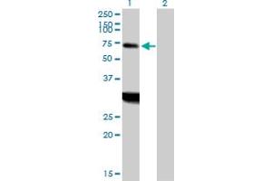 Western Blot analysis of ZNF238 expression in transfected 293T cell line by ZNF238 MaxPab polyclonal antibody. (ZNF238 anticorps  (AA 1-522))
