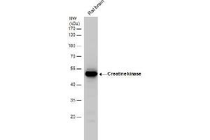 WB Image Creatine kinase (brain) antibody detects Creatine kinase protein by western blot analysis. (CKB anticorps)