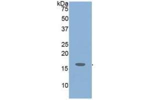 Detection antibody from the kit in WB with Positive Control:  Sample Mouse Cerebrum lysate.