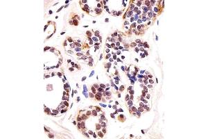 Immunohistochemical analysis of paraffin-embedded H.