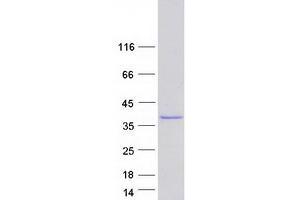 Validation with Western Blot