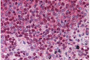 Spleen (TACI anticorps  (AA 116-132))