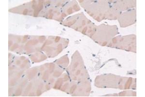 Figure. (Adiponectin Receptor 2 anticorps  (AA 1-147))