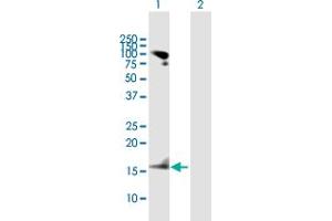 Western Blot analysis of RARRES2 expression in transfected 293T cell line by RARRES2 MaxPab polyclonal antibody.