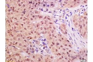 Formalin-fixed and paraffin embedded rat pancreas labeled with Anti-CTDSP2 Polyclonal Antibody, Unconjugated  at 1:200 followed by conjugation to the secondary antibody and DAB staining.