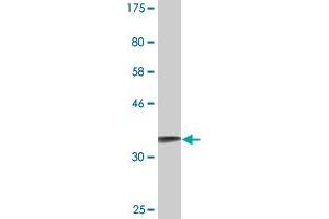 Western Blot detection against Immunogen (36. (S100A2 anticorps  (AA 1-97))