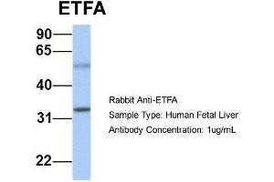 Host: Rabbit  Target Name: ETFA  Sample Tissue: Human Fetal Liver  Antibody Dilution: 1. (ETFA anticorps  (N-Term))