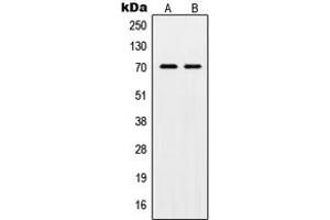 Western blot analysis of POT1 expression in HL60 (A), HeLa (B) whole cell lysates. (POT1 anticorps  (Center))