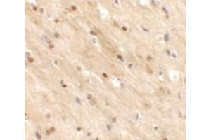 Immunohistochemistry of TMEM59L in mouse brain tissue with TMEM59L antibody at 2.
