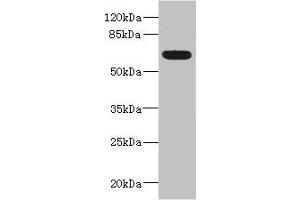 Western blot All lanes: ALCAMantibody IgG at 5. (CD166 anticorps  (AA 28-180))