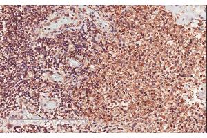 ABIN625822 (2µg/ml) staining of paraffin embedded Human Lymph Node. (CD28 anticorps  (Internal Region))