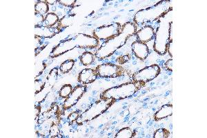 Immunohistochemistry of paraffin-embedded Mouse kidney using IL23R Rabbit pAb (ABIN3022245, ABIN3022246, ABIN3022247, ABIN1513088 and ABIN6218691) at dilution of 1:100 (40x lens).