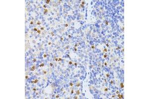 Immunohistochemistry of paraffin-embedded mouse spleen using SMAD2 antibody.