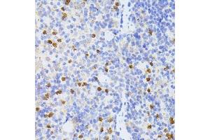Immunohistochemistry of paraffin-embedded mouse spleen using SMAD2 antibody. (SMAD2 anticorps  (AA 1-100))