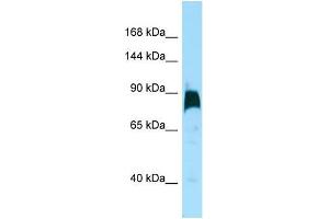 Western Blotting (WB) image for anti-Kinesin Family Member 7 (KIF7) (C-Term) antibody (ABIN2490336) (KIF7 anticorps  (C-Term))