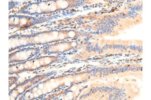 ABIN6267069 at 1/100 staining mouse intestinal tissue sections by IHC-P.