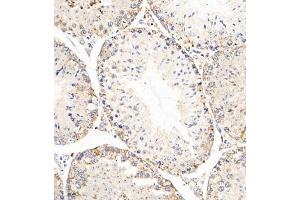 Immunohistochemistry of paraffin embedded mouse testis using AZI2 (ABIN7072856) at dilution of 1:650 (300x lens) (AZI2 anticorps)