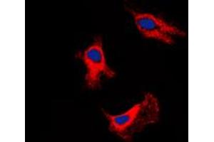 Immunofluorescent analysis of Adenosine A2b Receptor staining in SHSY5Y cells. (Adenosine A2b Receptor anticorps  (C-Term))