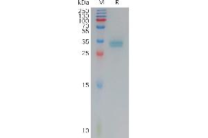 Human C(144-156) Protein, mFc Tag on SDS-PAGE under reducing condition.