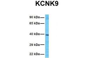 Host:  Rabbit  Target Name:  KCNK9  Sample Tissue:  Human 293T  Antibody Dilution:  1. (KCNK9 anticorps  (N-Term))
