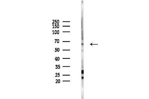 anti-RIO Kinase 2 (RIOK2) (Internal Region) antibody