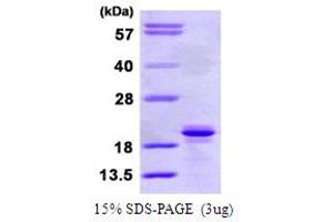 SDS-PAGE (SDS) image for Signaling threshold Regulating Transmembrane Adaptor 1 (SIT1) (AA 62-196) protein (His tag) (ABIN6386801)
