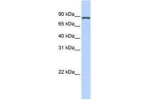Image no. 1 for anti-Cytoplasmic Polyadenylation Element Binding Protein 4 (CPEB4) (AA 72-121) antibody (ABIN6740707)