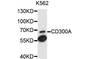 Western blot analysis of extracts of K562 cells, using CD300A antibody. (CD300a anticorps)