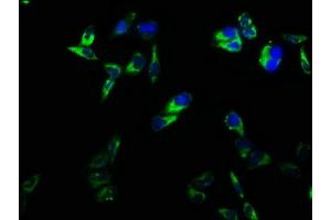 Immunofluorescence staining of Hela cells with ABIN7171365 at 1:166, counter-stained with DAPI. (CD2 anticorps  (AA 25-209))