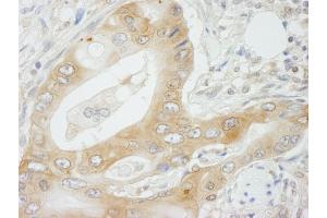 Immunohistochemistry (IHC) image for anti-N-Myc (And STAT) Interactor (NMI) (C-Term) antibody (ABIN7448693)