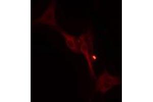 ABIN6274997 staining  MCF7 cells by IF/ICC. (RRP8 anticorps  (Internal Region))