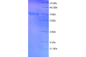 Ribosomal Protein S18 (RPS18) (AA 2-152), (full length) protein (GST tag)